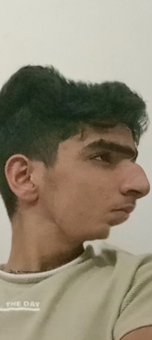 Retouch 2026032518211482