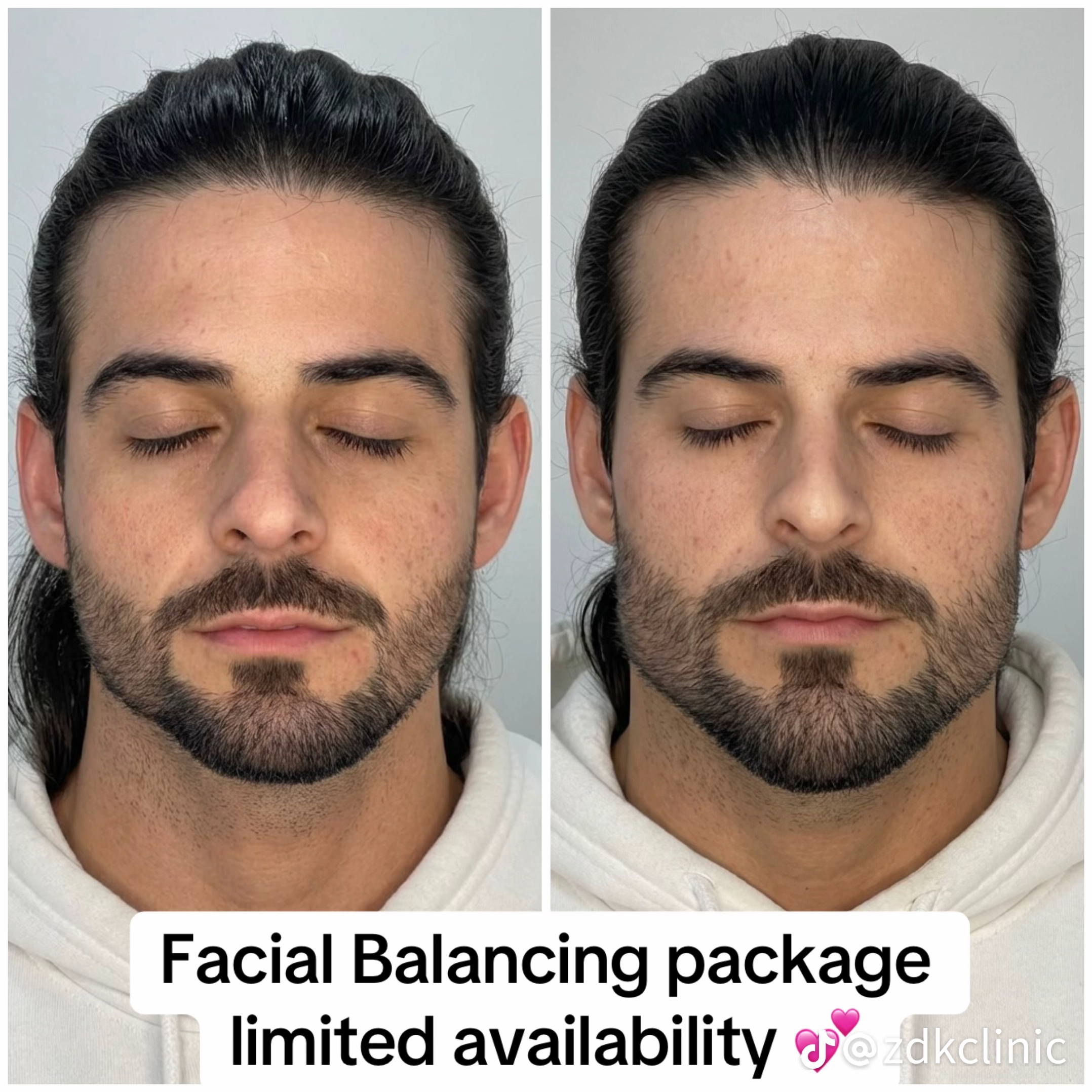 Temp image 8AF7F276 EF11 42F9 B99E FECE49479DF1