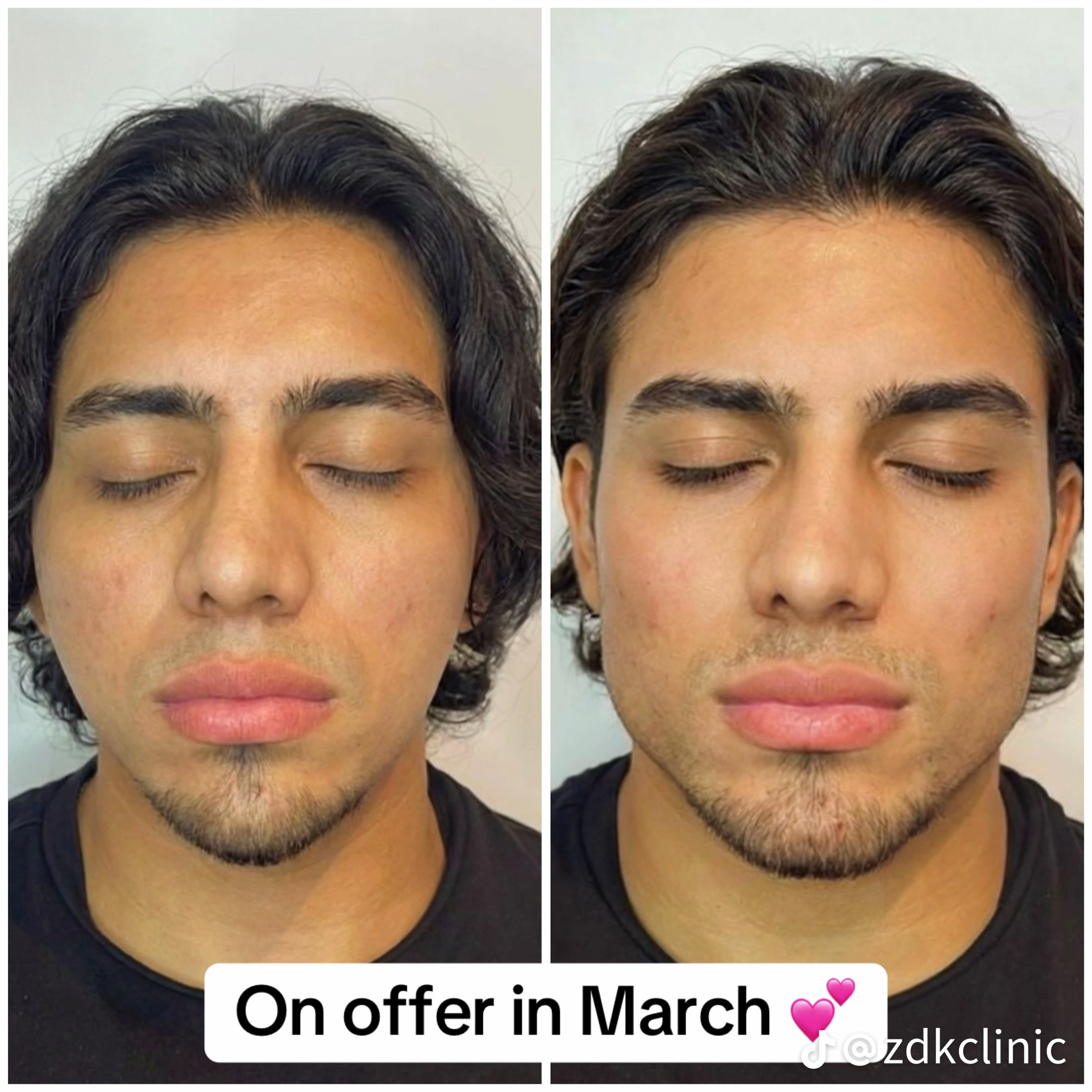 Temp image A17E8EB5 81A6 43B2 8F11 05E166E24F77