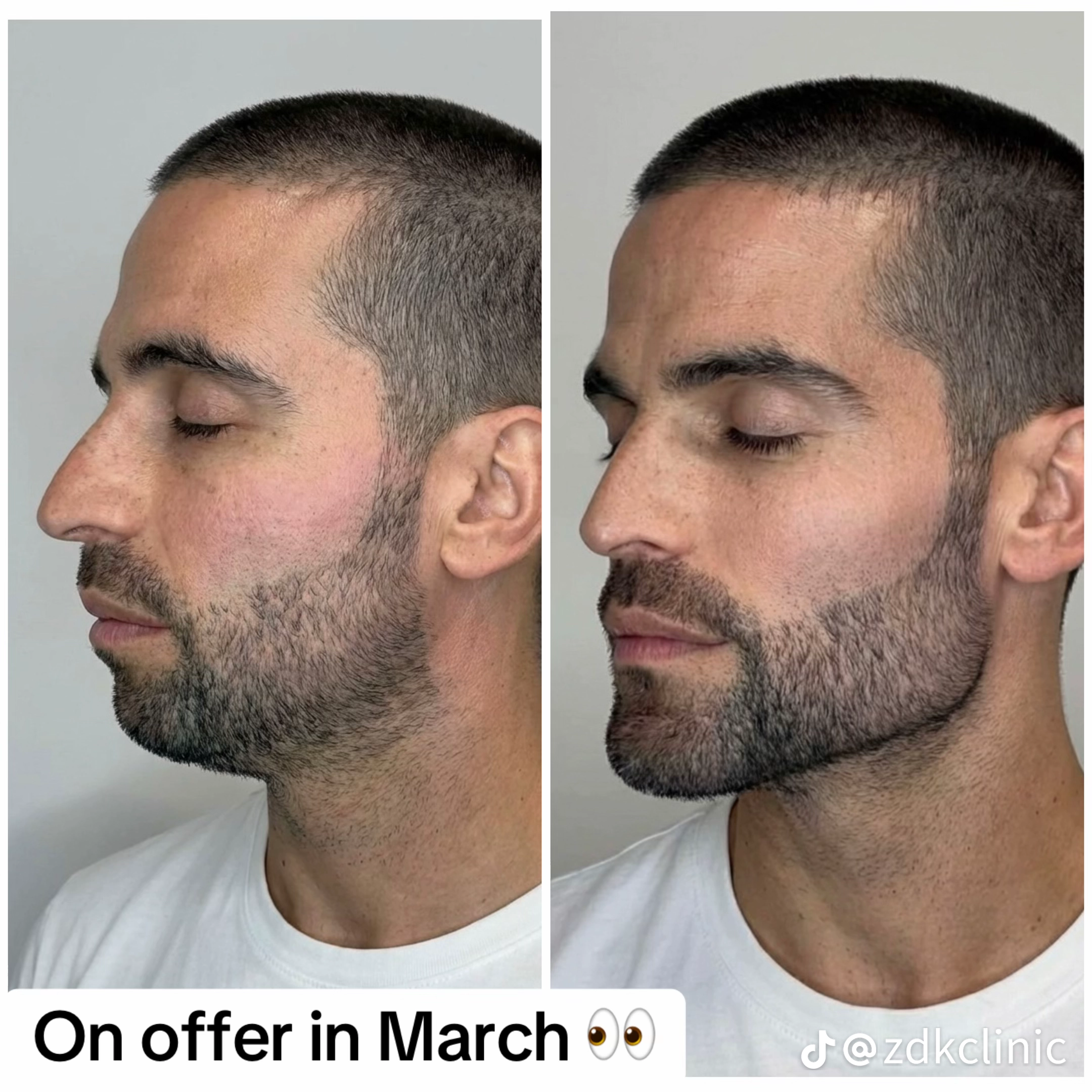 Temp image 75F30834 4A28 49A7 922D 637FCFE87D49