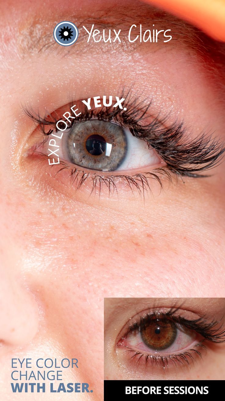 8112cea1263e8b6ffc2fc456427073b8