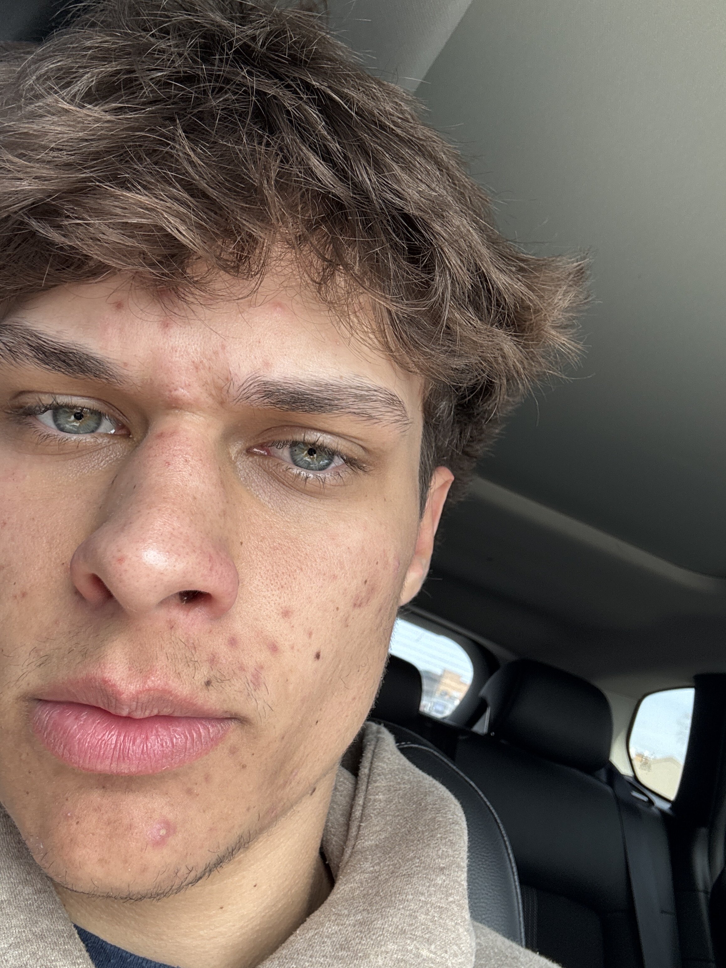 IMG 7E332132 8D61 477D 8B71 A1765BF79158