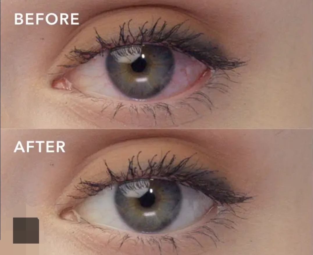 Screenshot 2026 03 30 10 34 39 267 edit comgoogleandroidgooglequicksearchbox