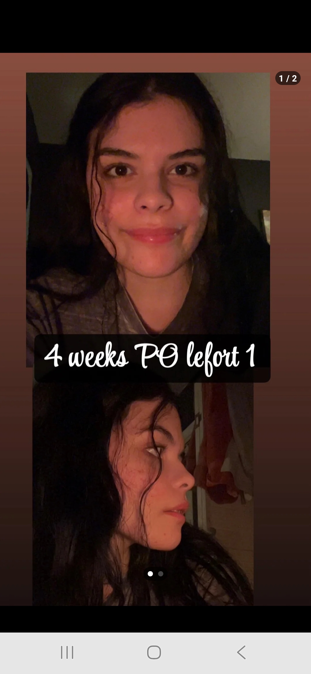 Screenshot 20260330 115545 Reddit