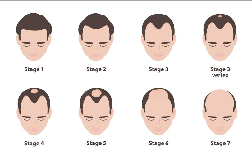 Screenshot 20260304 020119 com openai chatgpt MainActivity