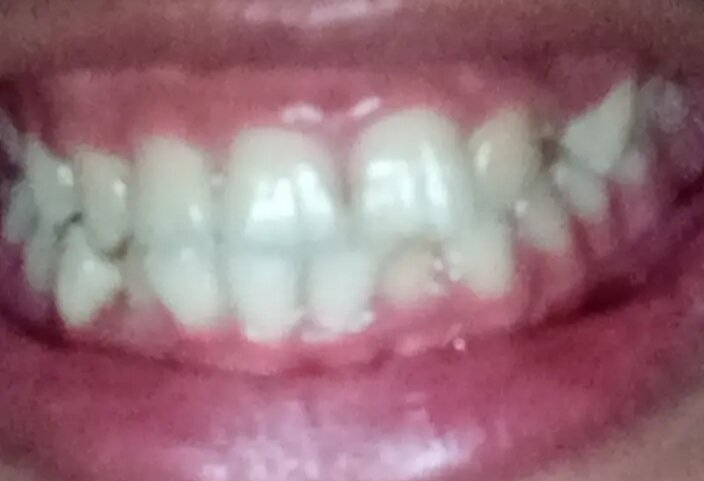 IMG_20260304_213928.jpg