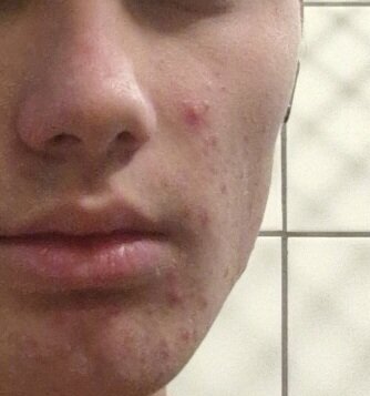 Snapchat 17980268931