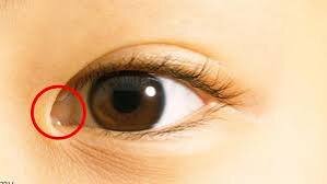 Images   2026 02 19T092330122