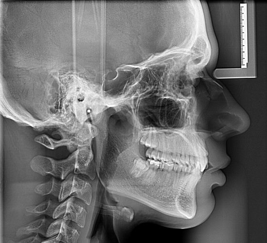 Zrzut ekranu 2026-03-05 210359.png