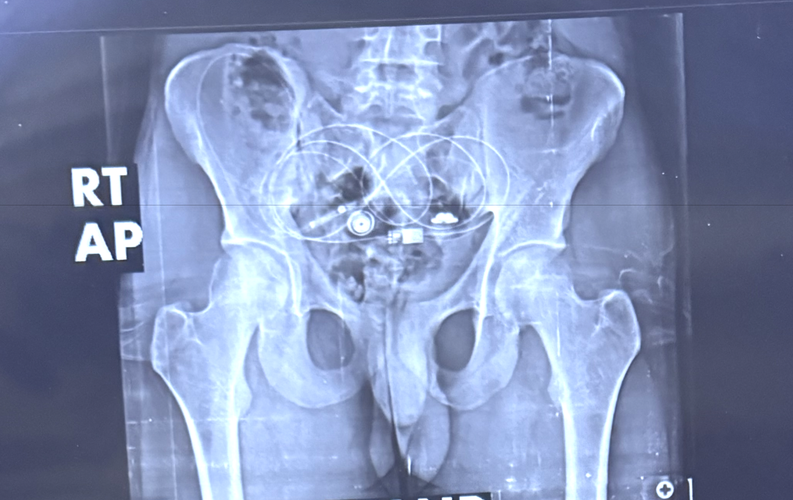 Screenshot 2026-03-10 at 12.06.19 am.png