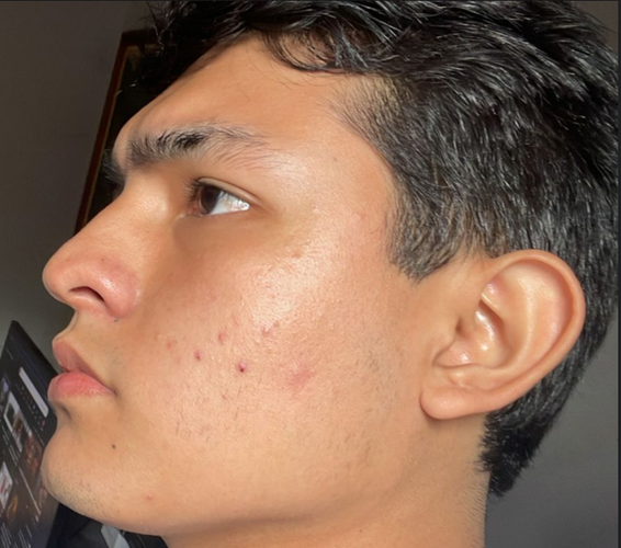 Screenshot 2026-03-07 111344.png