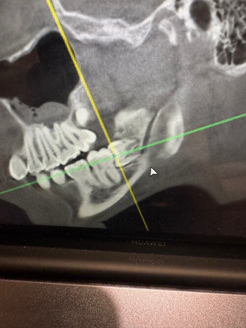 виздом тиз.jpg