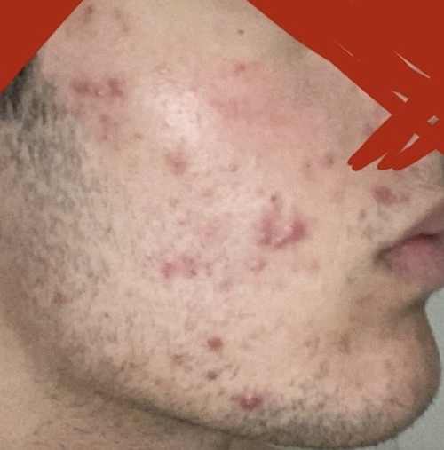 Screenshot 2026 03 14 at 42931pm