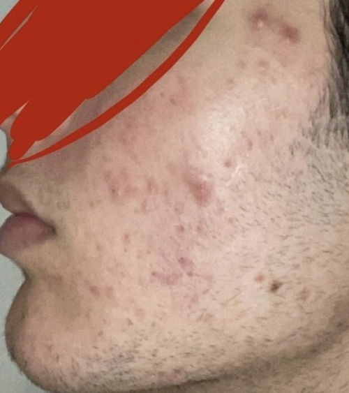 Screenshot 2026 03 14 at 42941pm