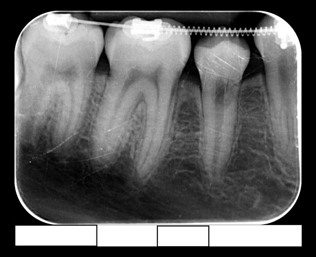 Dentist X-Ray.jpg