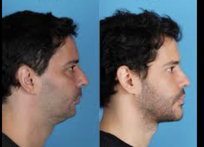 Screenshot 2026-03-19 at 3.21.22 PM.png