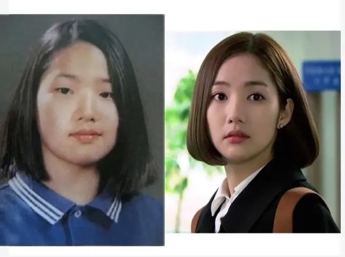 korean-actress-plastic-surgery-v0-0zcn4043ffof1.webp