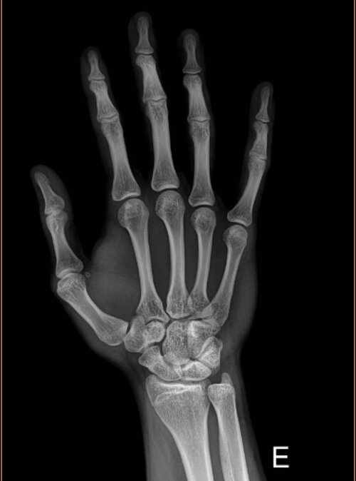xray2.jpeg