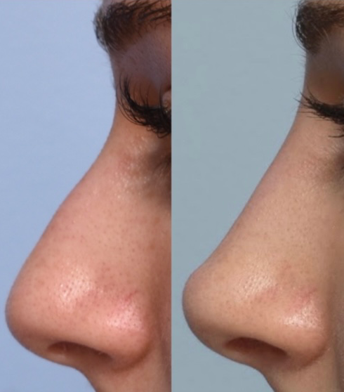 Screenshot 2026 03 26 224734