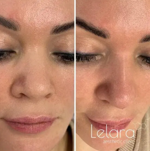 Screenshot 2026 03 26 224730