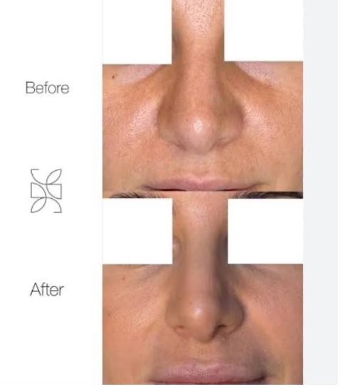 Screenshot 2026 03 26 224722