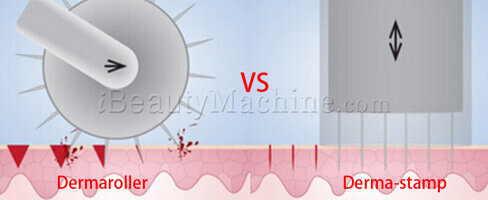 Dermaroller_VS_derma-stamp.jpg