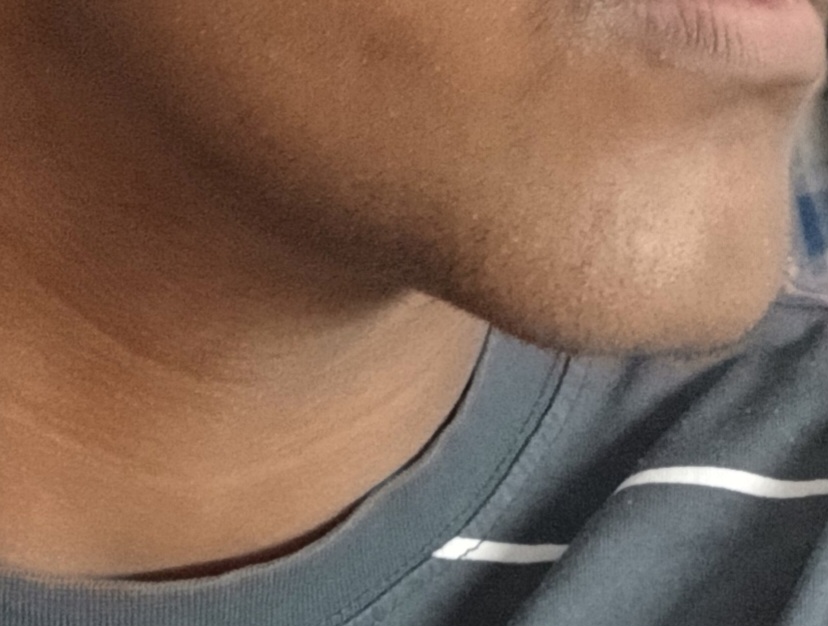 1513