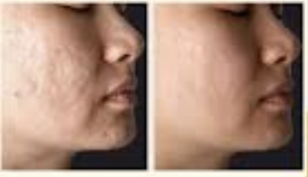 Screenshot 2026 04 02 at 162416