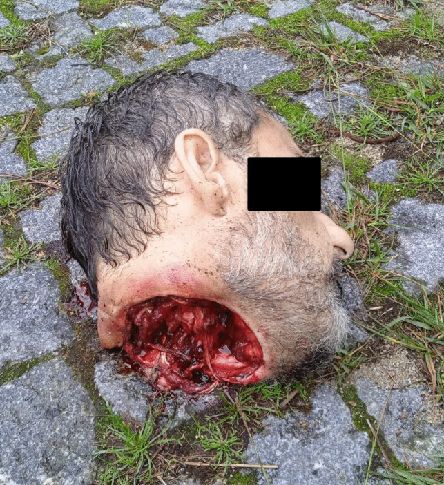 12024 2023 744 Fig2 HTML