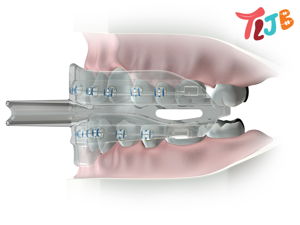 Tljb appliance card v100