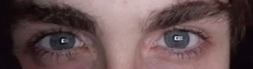 Eye2