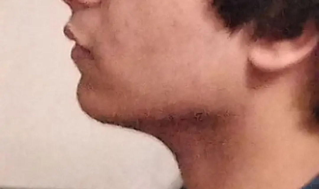 1000029705