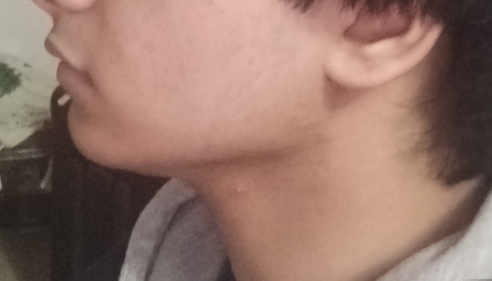 1000029725
