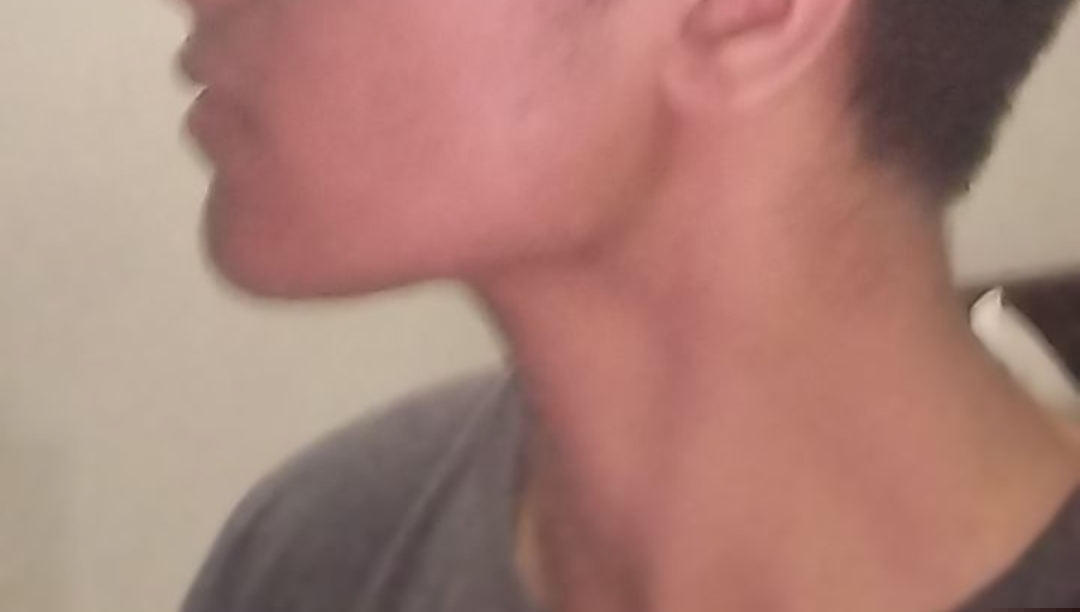 1000029713
