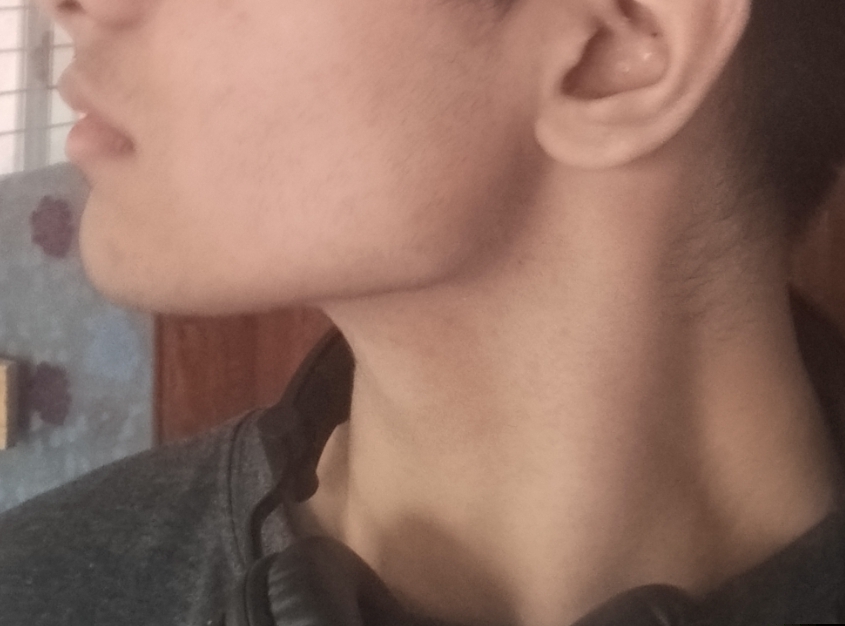 1000029715