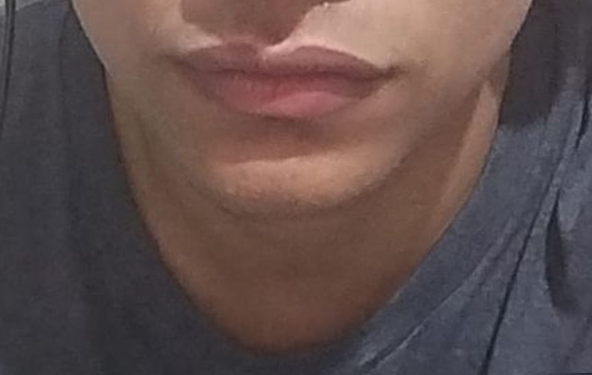1000029696