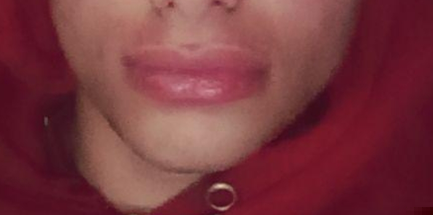 1000029721