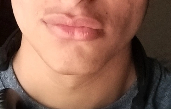 1000029733