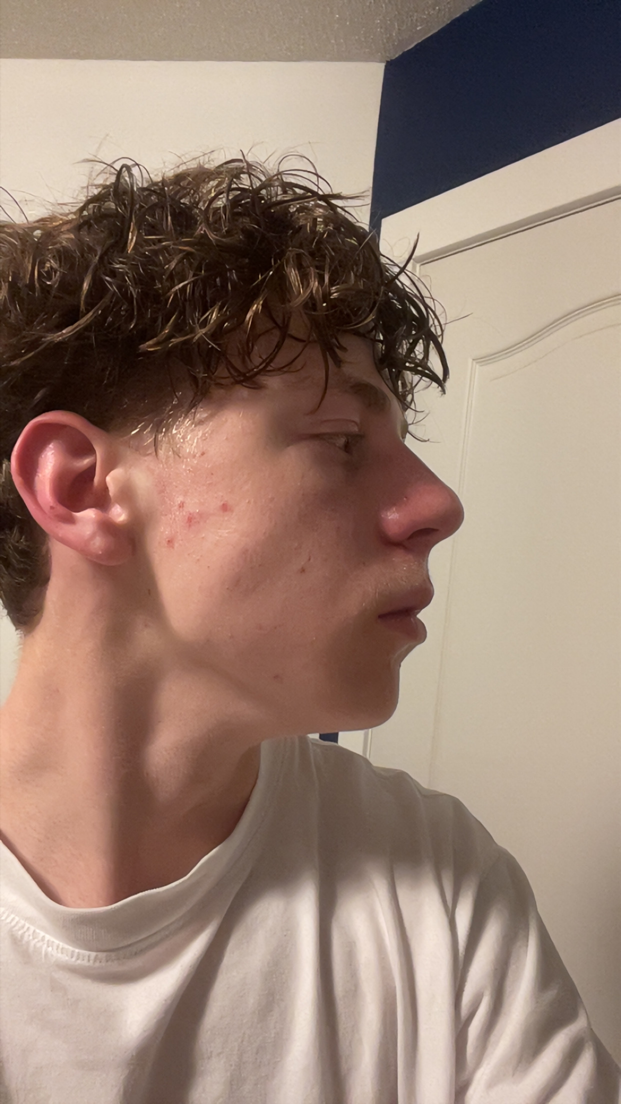 IMG 1762
