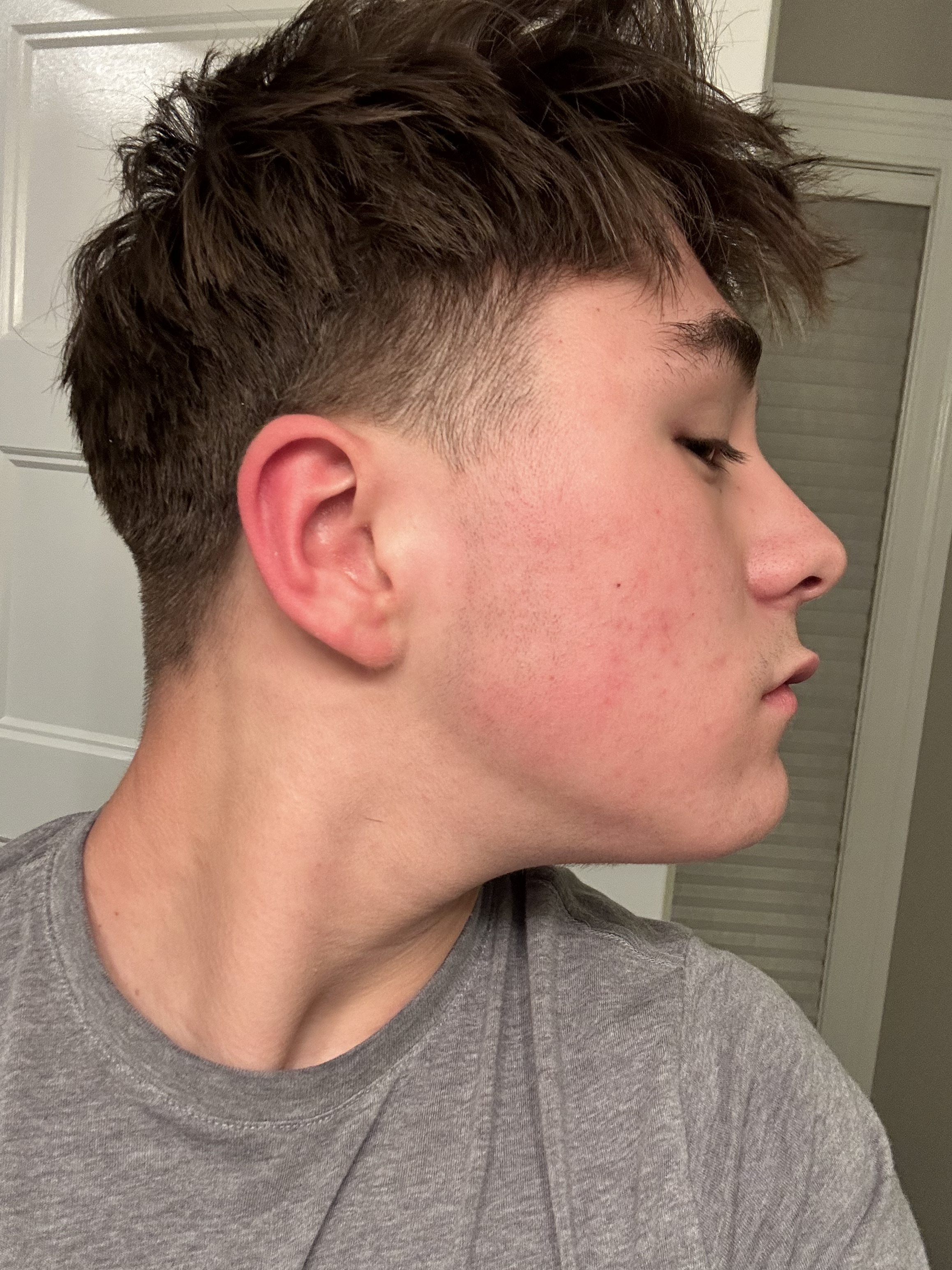 IMG 0447