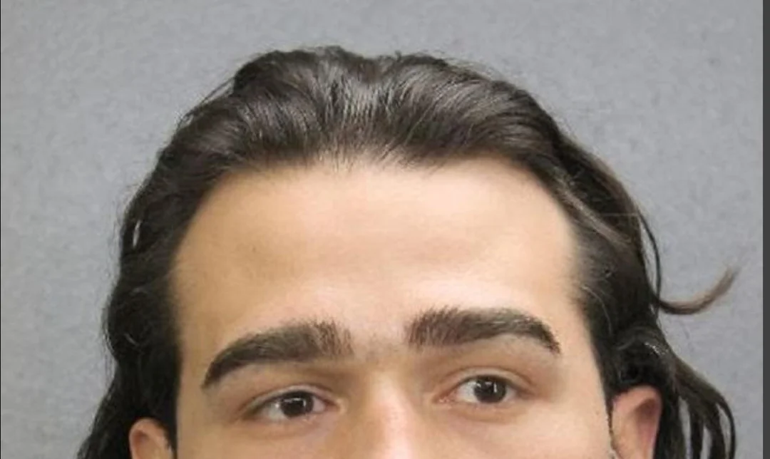 Am i balding v0 bs7bp2snhnrg1