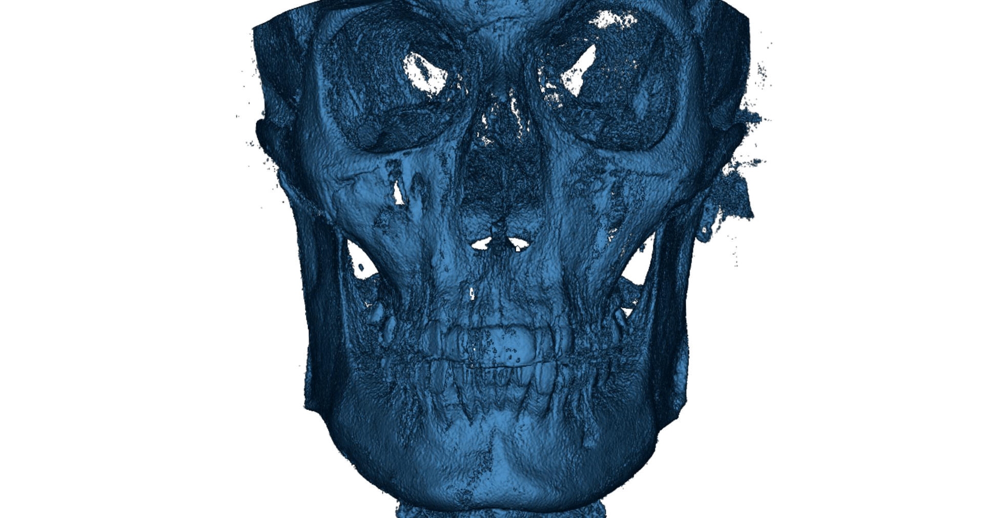 Fme case study v0 9o7ep61wdene1