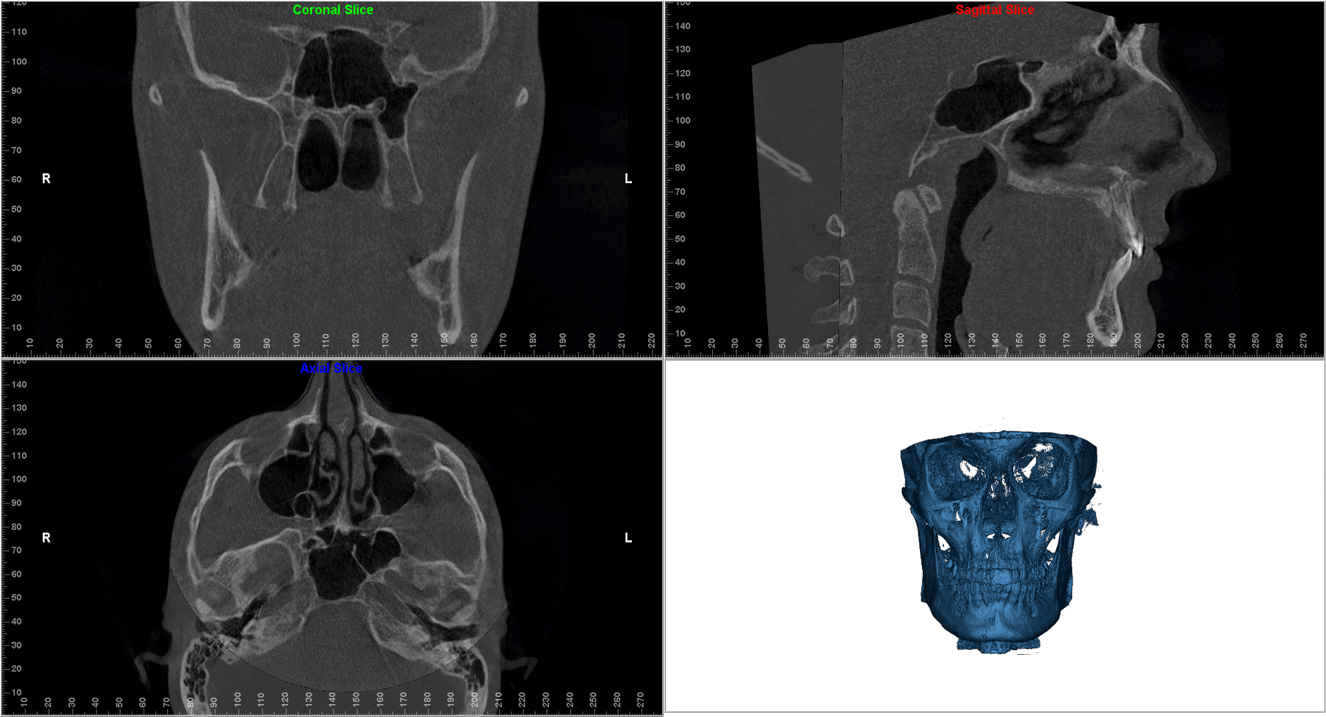 Fme case study v0 lprpxi53aene1