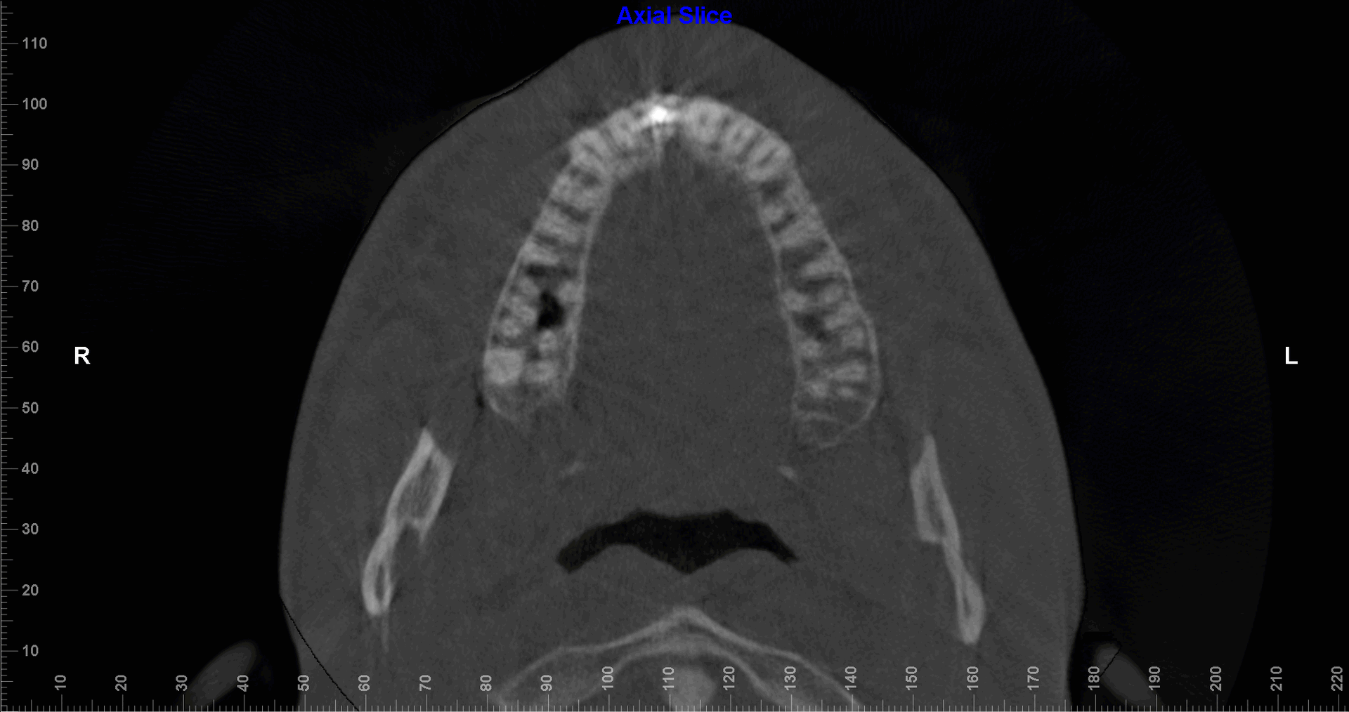 Fme case study v0 x7j70xhp9ene1