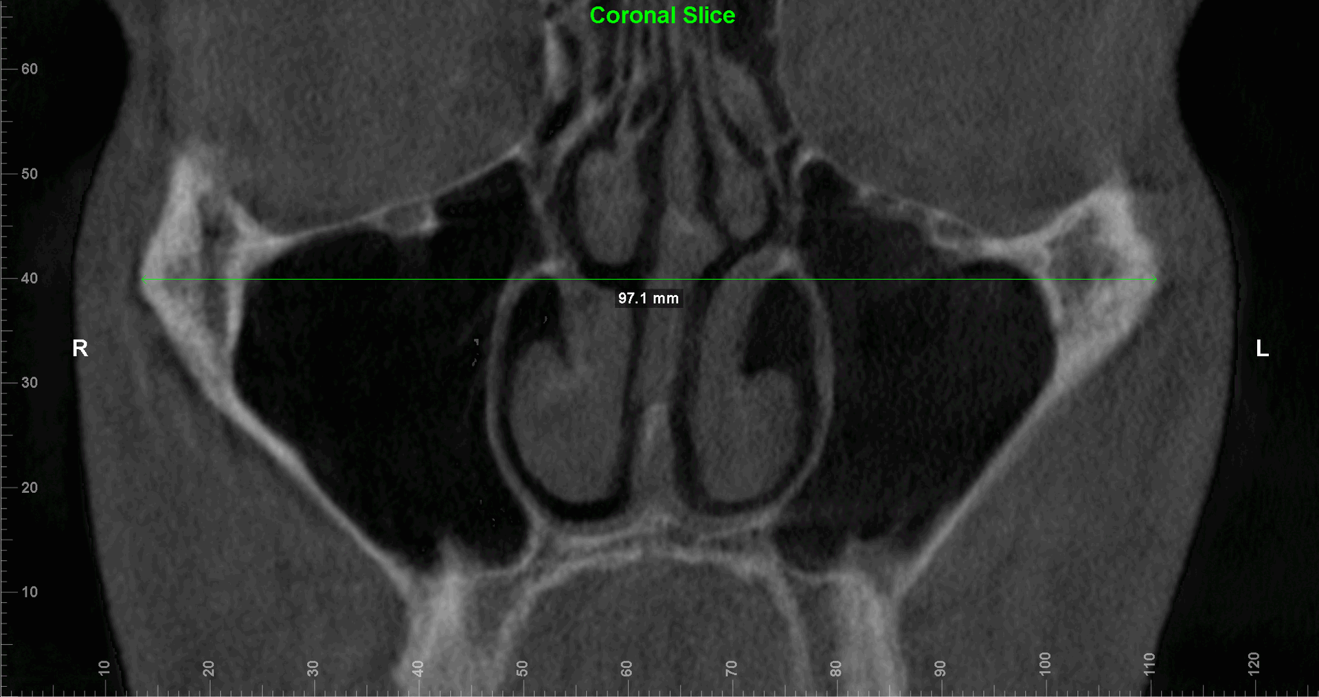 Fme case study v0 9w59q94x9ene1