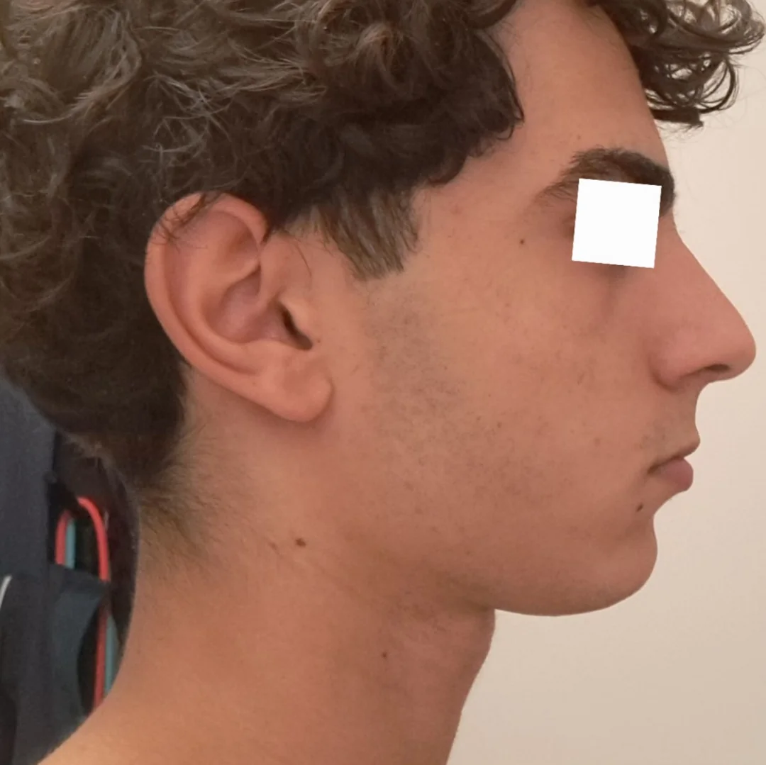 IMG 2220
