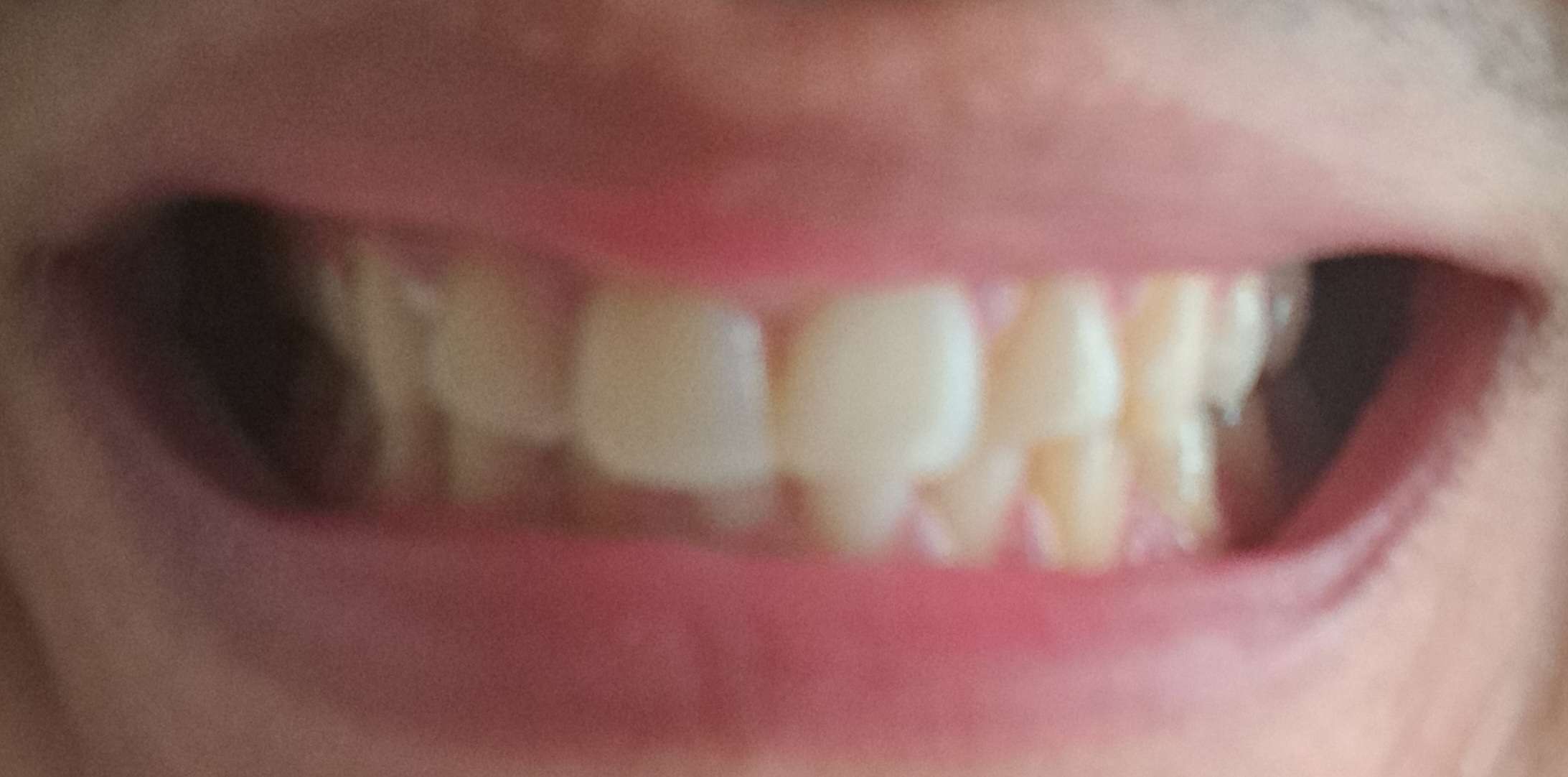 Teeth 1