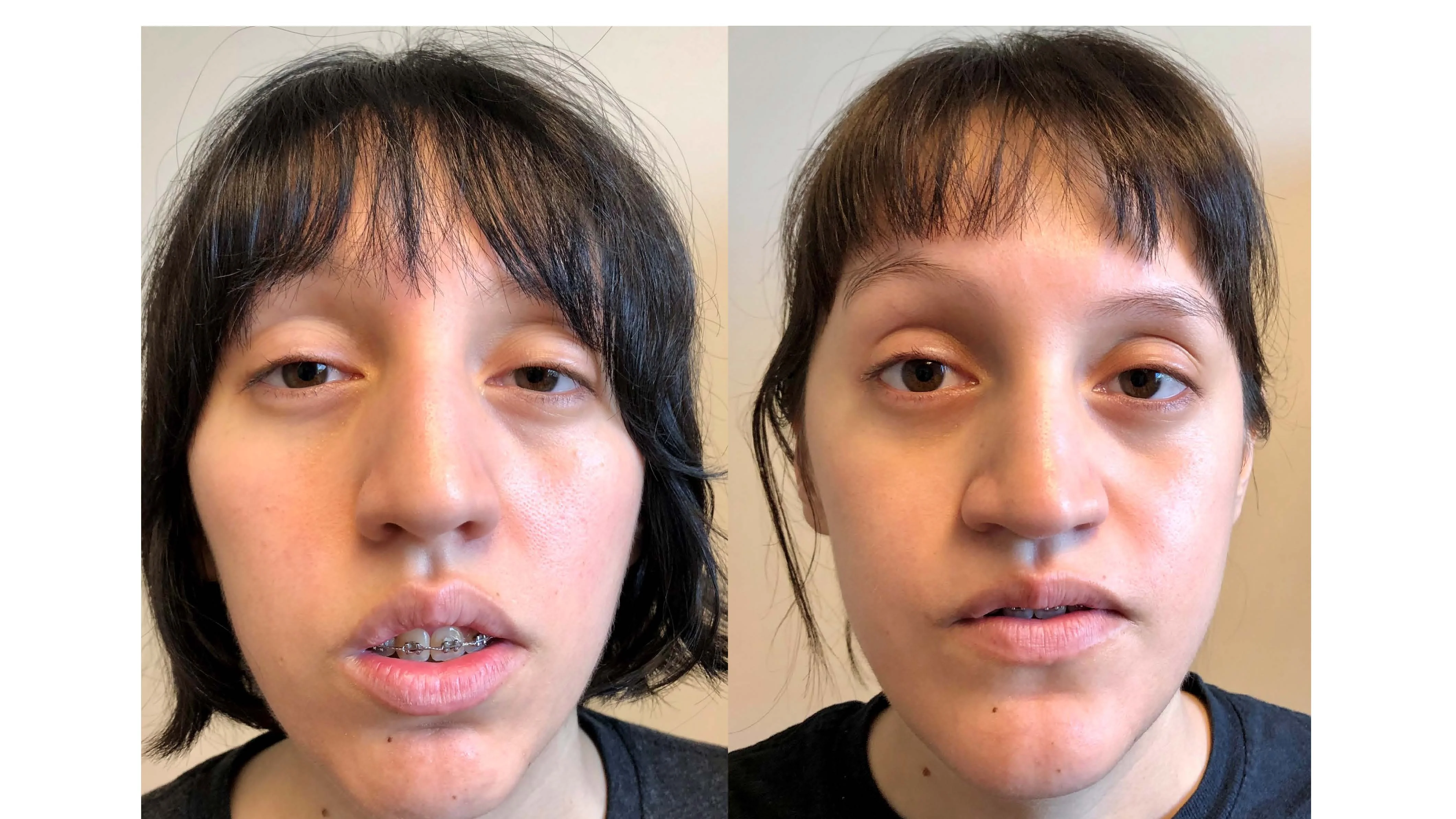 IMG 2942