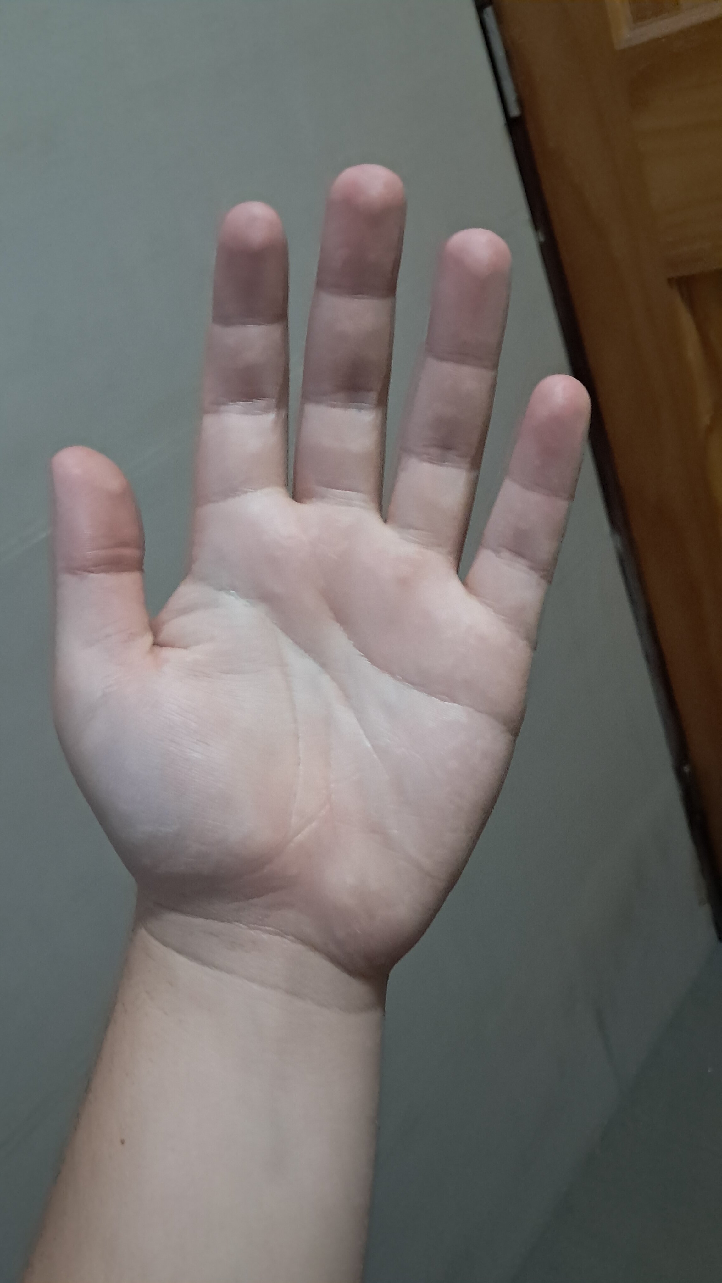 20260411 172240
