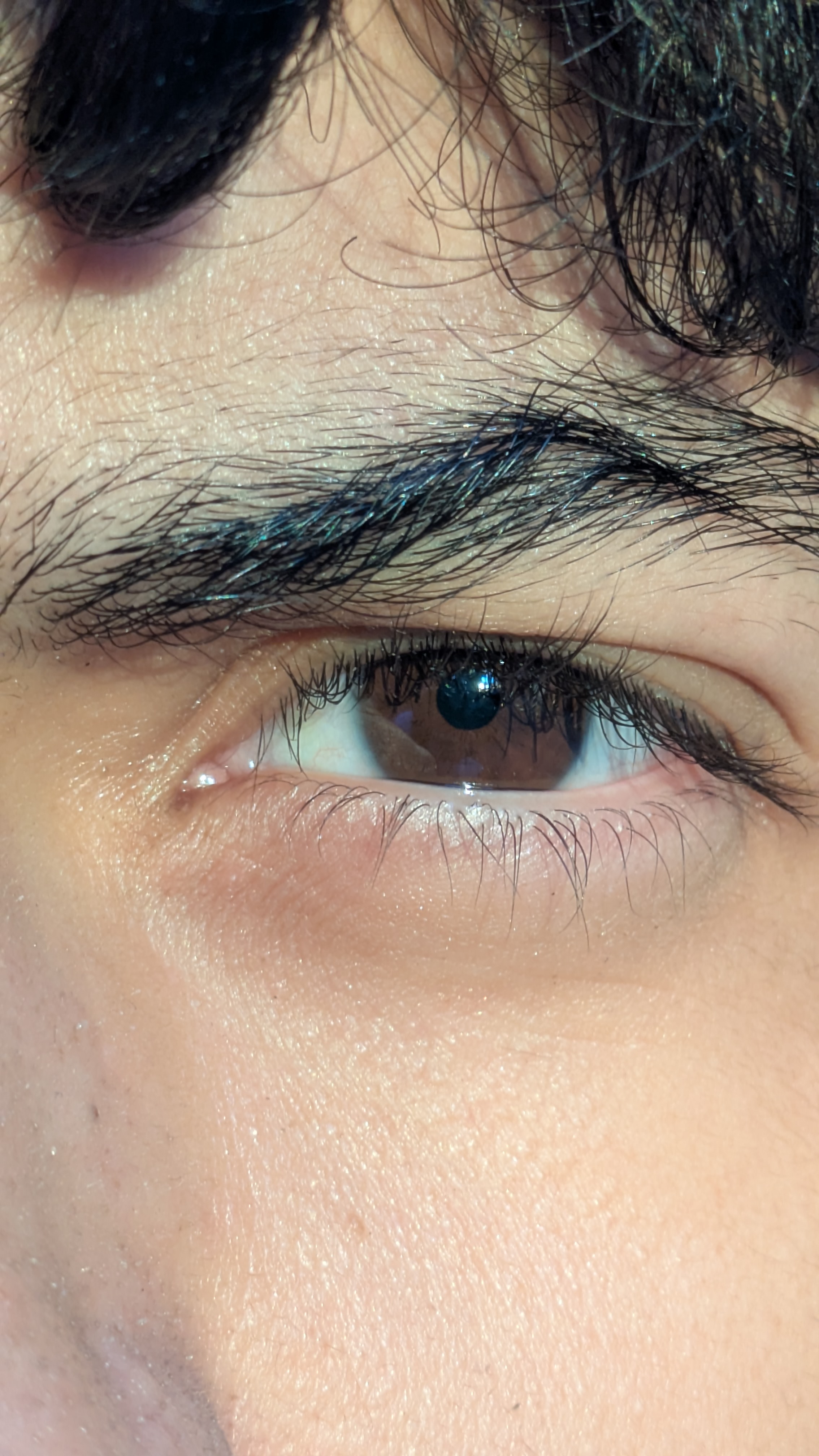 Eye
